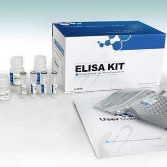 人甲状腺球蛋白抗体试剂盒 TGAb试剂盒 甲状腺球蛋白抗体ELISA试剂盒 厂家直销