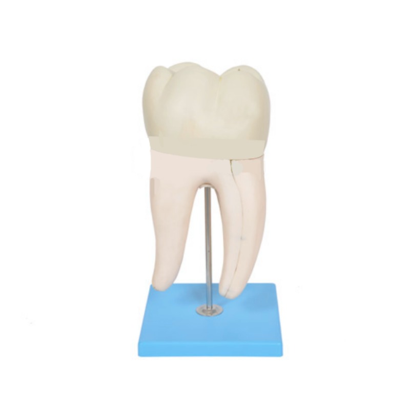 磨牙有两个牙根模型实训考核装置   磨牙有两个牙根模型实训设备  磨牙有两个牙根模型综合实训台