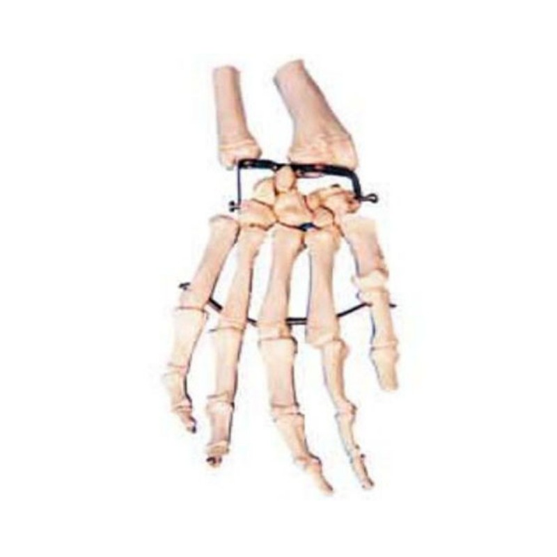 手掌骨模型实训考核装置  手掌骨模型实训设备  手掌骨模型综合实训台