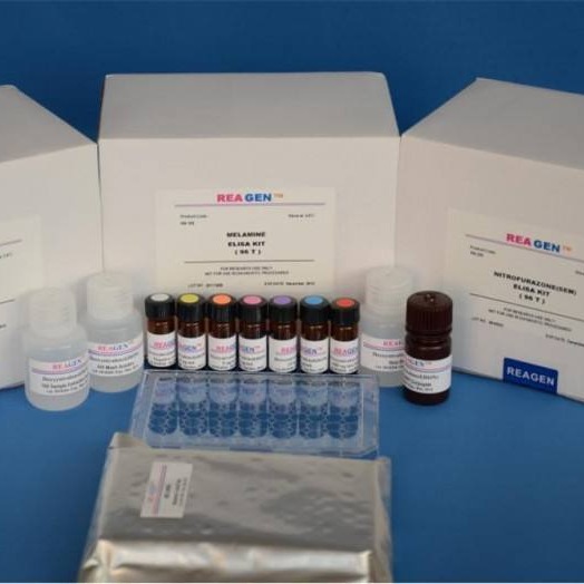 人抗白蛋白抗体试剂盒 AAA试剂盒 抗白蛋白抗体ELISA试剂盒 厂家直销